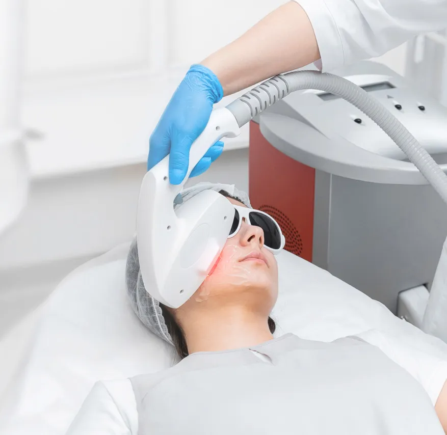 IPL photofacial treatment for skin rejuvenation. Advanced laser therapy reduces pigmentation, sun damage, and improves skin tone.