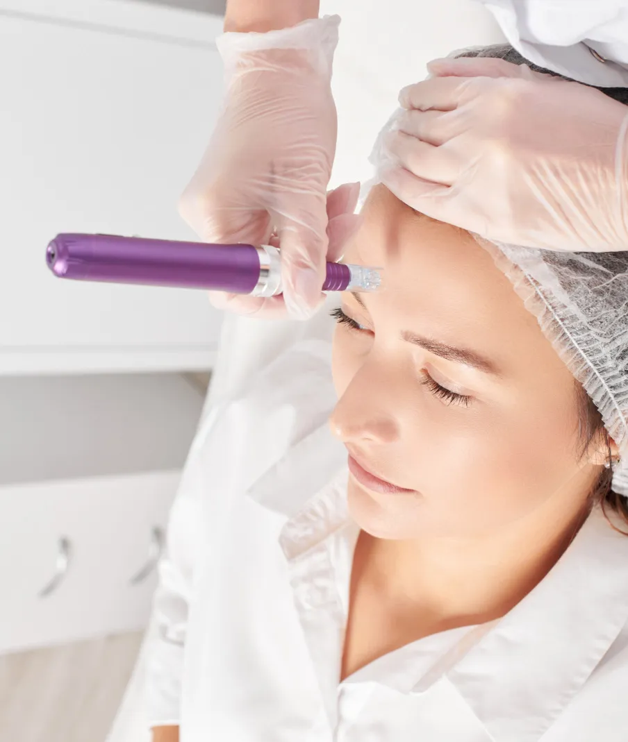 Microneedling treatment at a dermatology clinic to stimulate collagen production and improve skin texture and elasticity.
